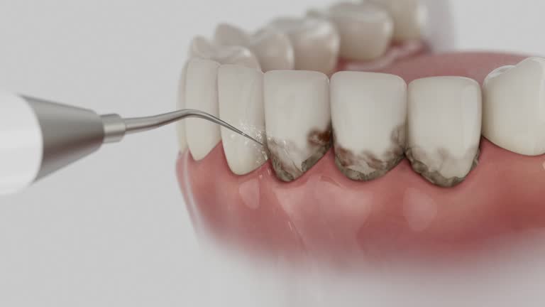 Trusted Tooth Extraction service in The Dalles, OR - Dentist Open Now